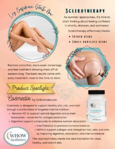 Sclerotherapy treatment advertisement with product spotlight.